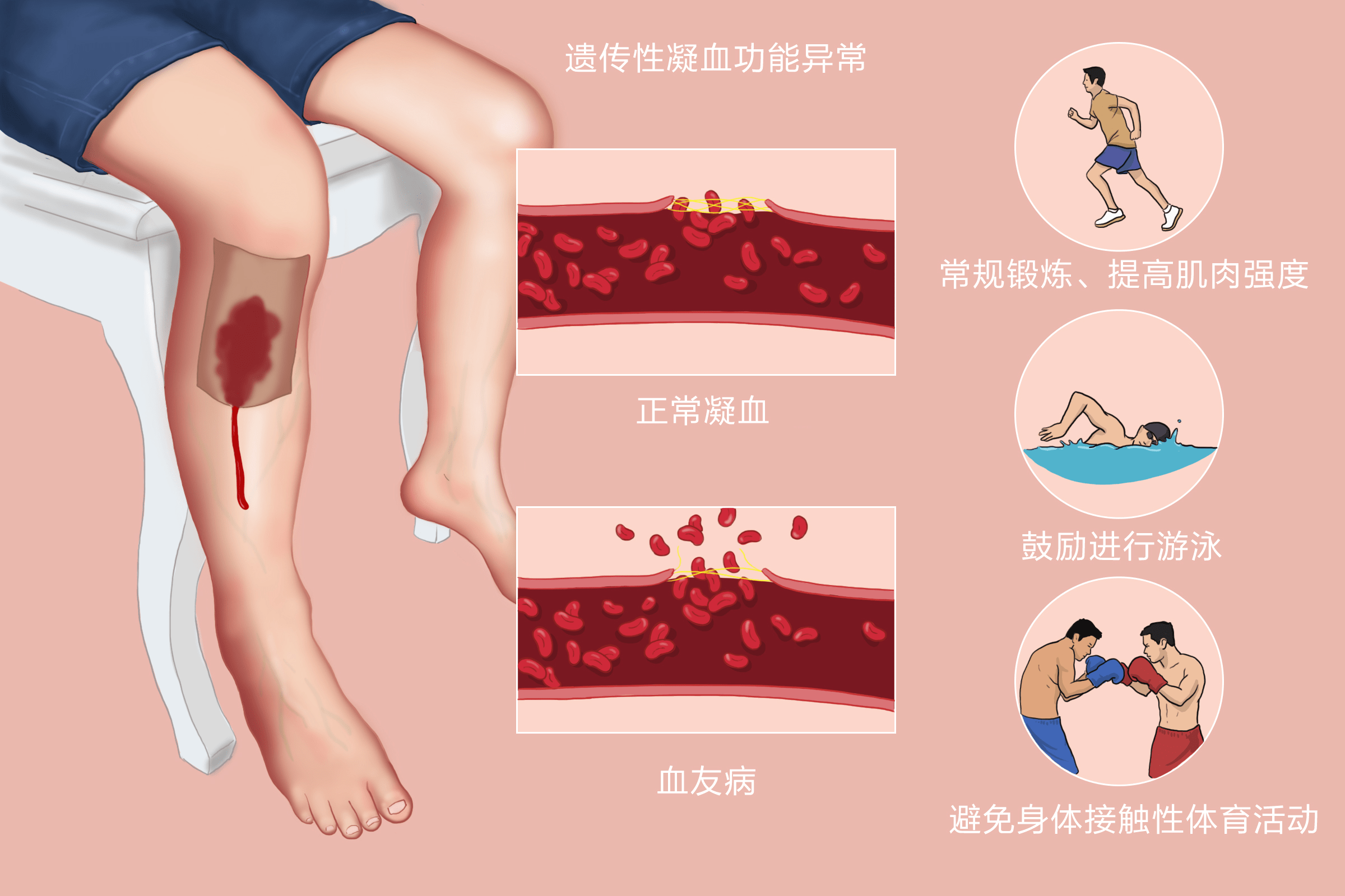 恋狱月狂病结局_恋狱月狂病_恋狱月狂病剧情整理